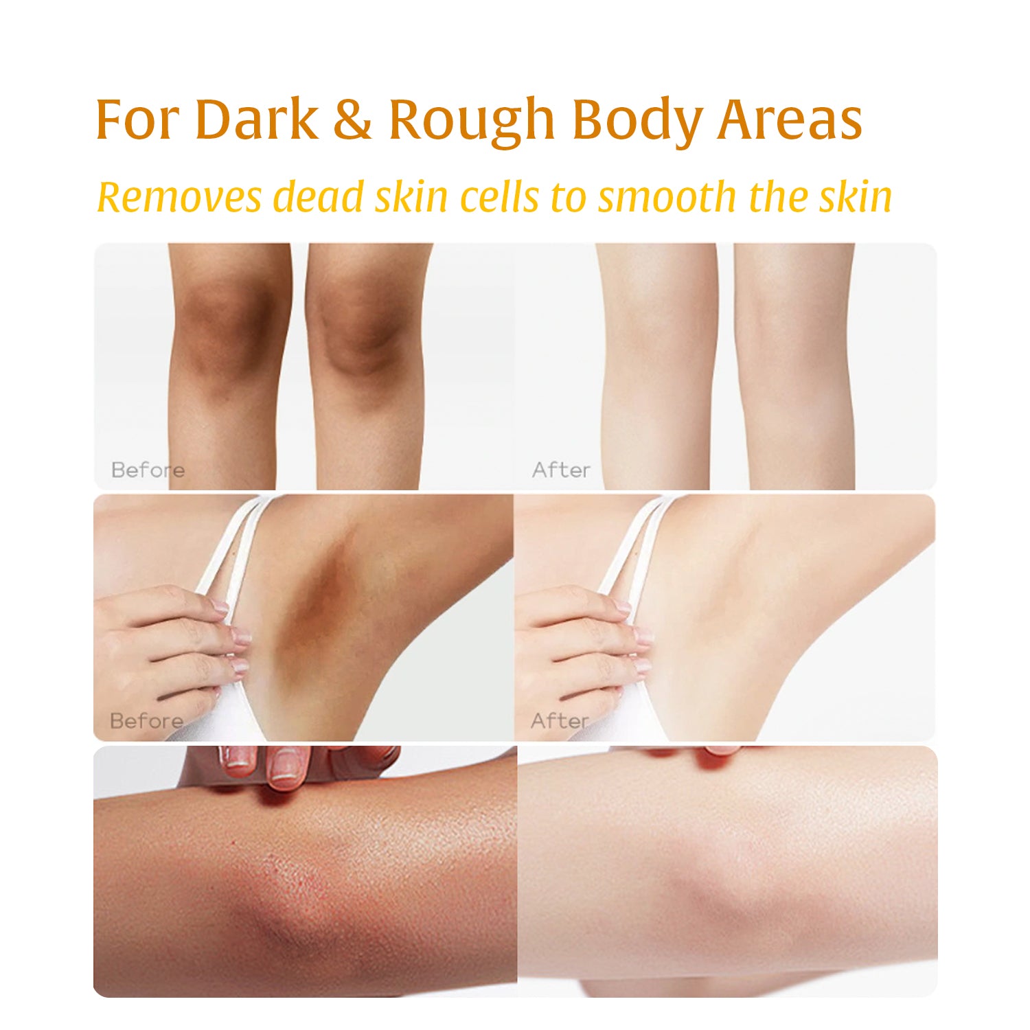 2-in-1 Turmeric & Kojic Acid Brightening Set : Dark Spot Remover, Dead Skin Cells Remover, Skin Brightening, Even Tone