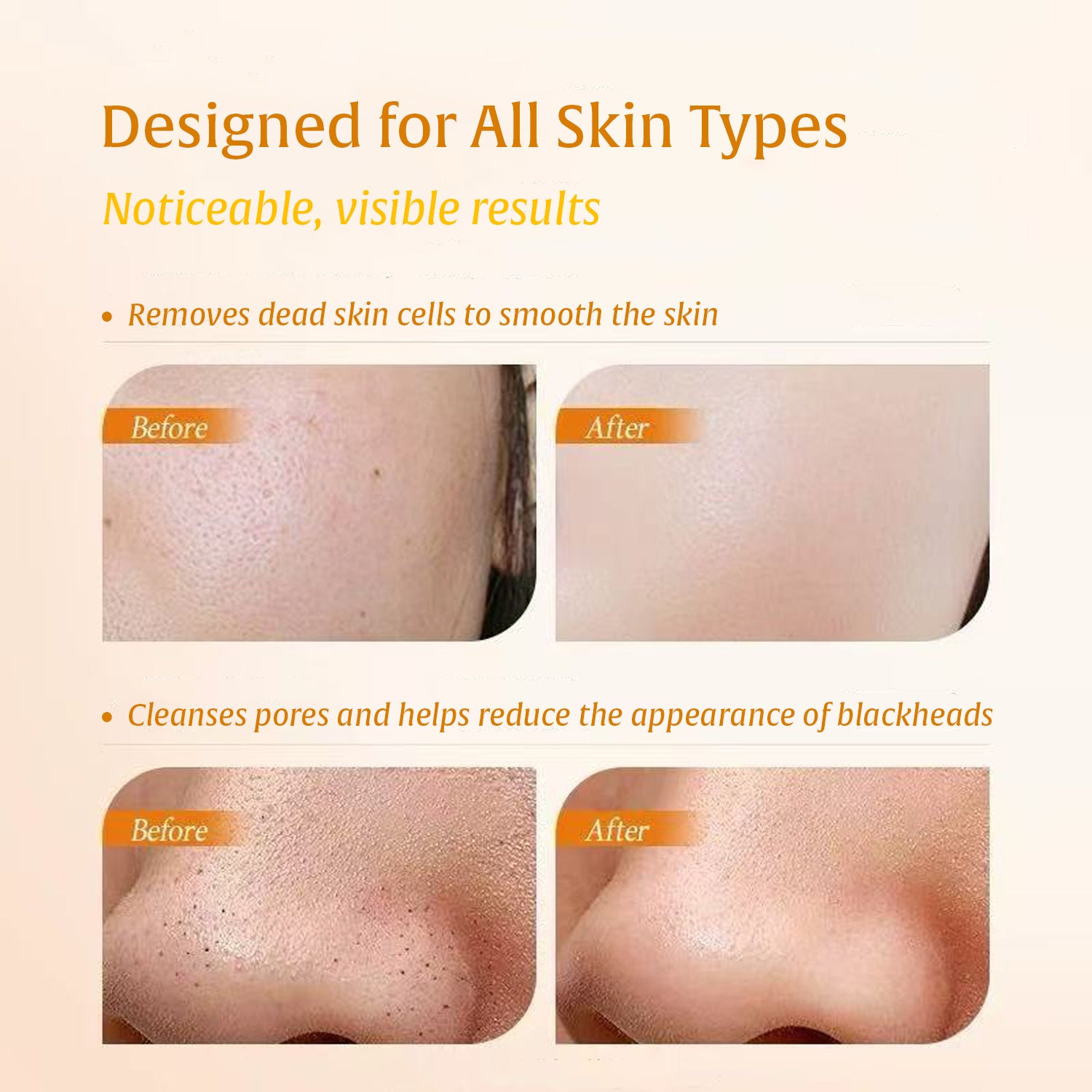 Turmeric Kojic Acid Face & Body Exfoliating Gel Peel Shot– Dead Skin Remover for Underarms, Inner Thighs & Knees, Dark Spot Corrector