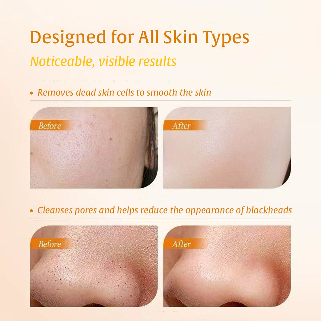 2-in-1 Turmeric & Kojic Acid Brightening Set : Dark Spot Remover, Dead Skin Cells Remover, Skin Brightening, Even Tone