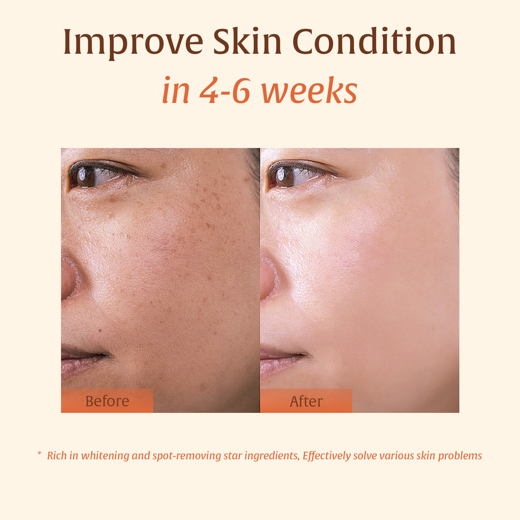 3-in-1 Turmeric & Kojic Acid Brightening Set: Turmeric Face Wash, Dark Spot Remover, Dead Skin Cells Remover, Skin Brightening, Even Tone